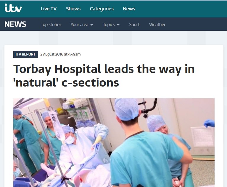 Torbay Hospital lead the way in natural c-section – ITV coverage featured image