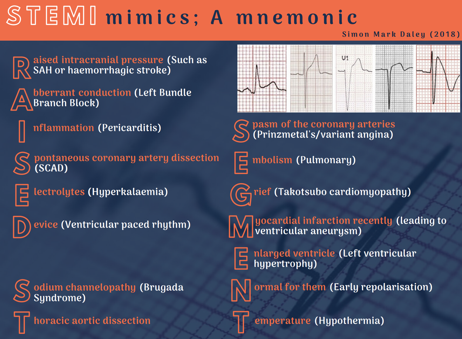 stemi-mimics-a-mnemonic-fab-nhs-stuff