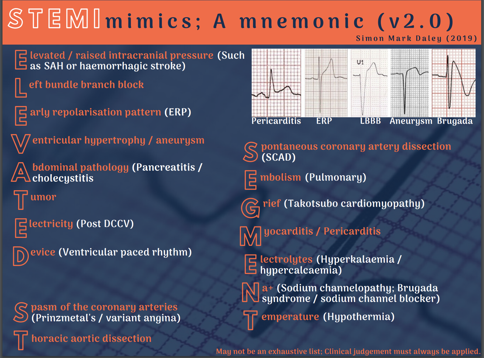 12 Lead Stemi Chart