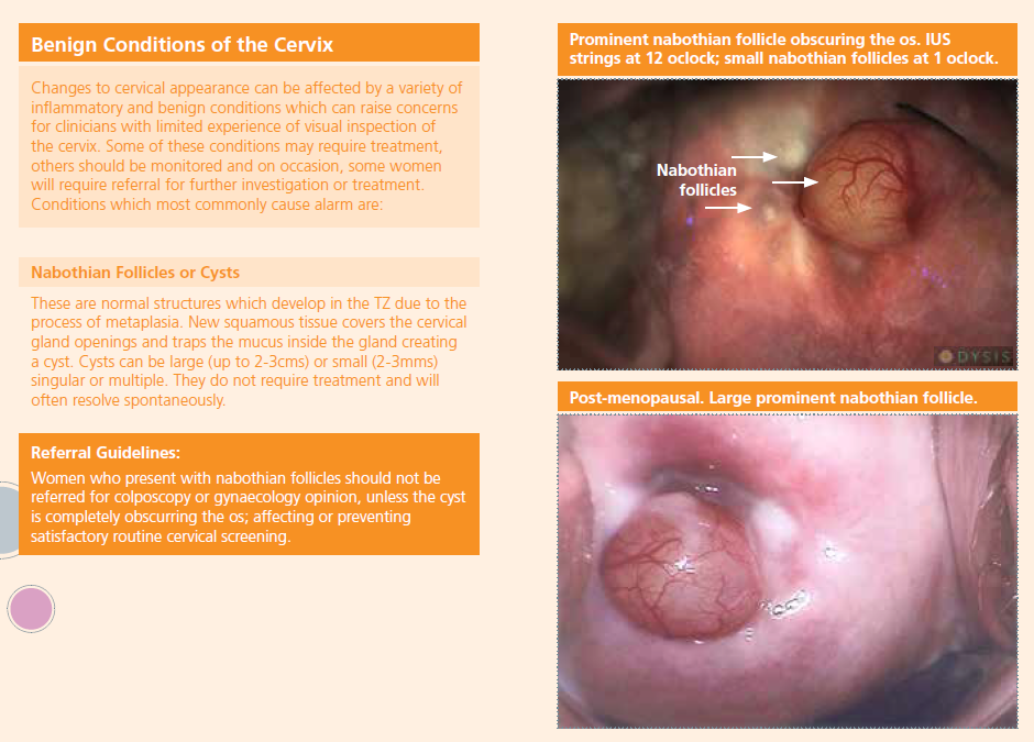 The Cervix Visual Assessment Guide featured image